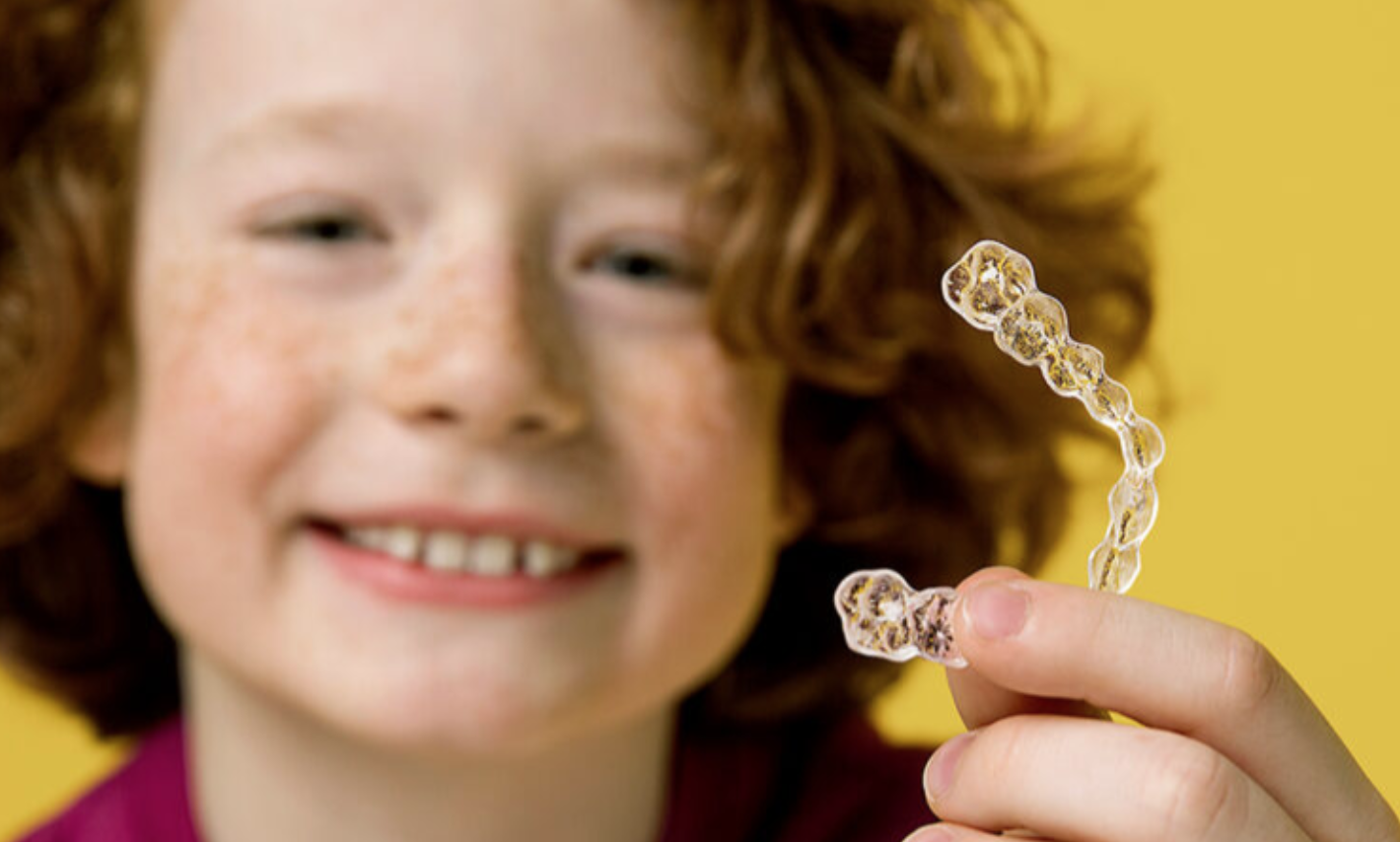 Straight Talk: Invisalign First for Early Orthodontic Treatment