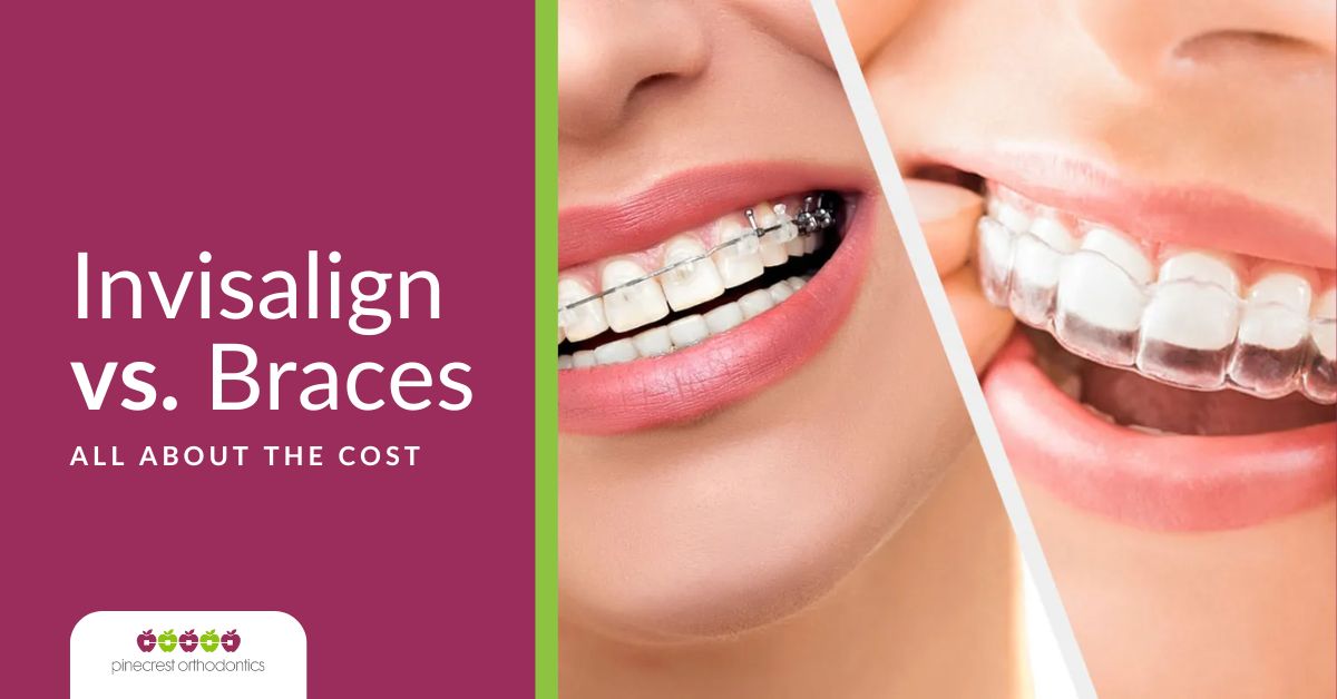 Invisalign vs Braces Cost in Miami at Pinecrest Orthodontics
