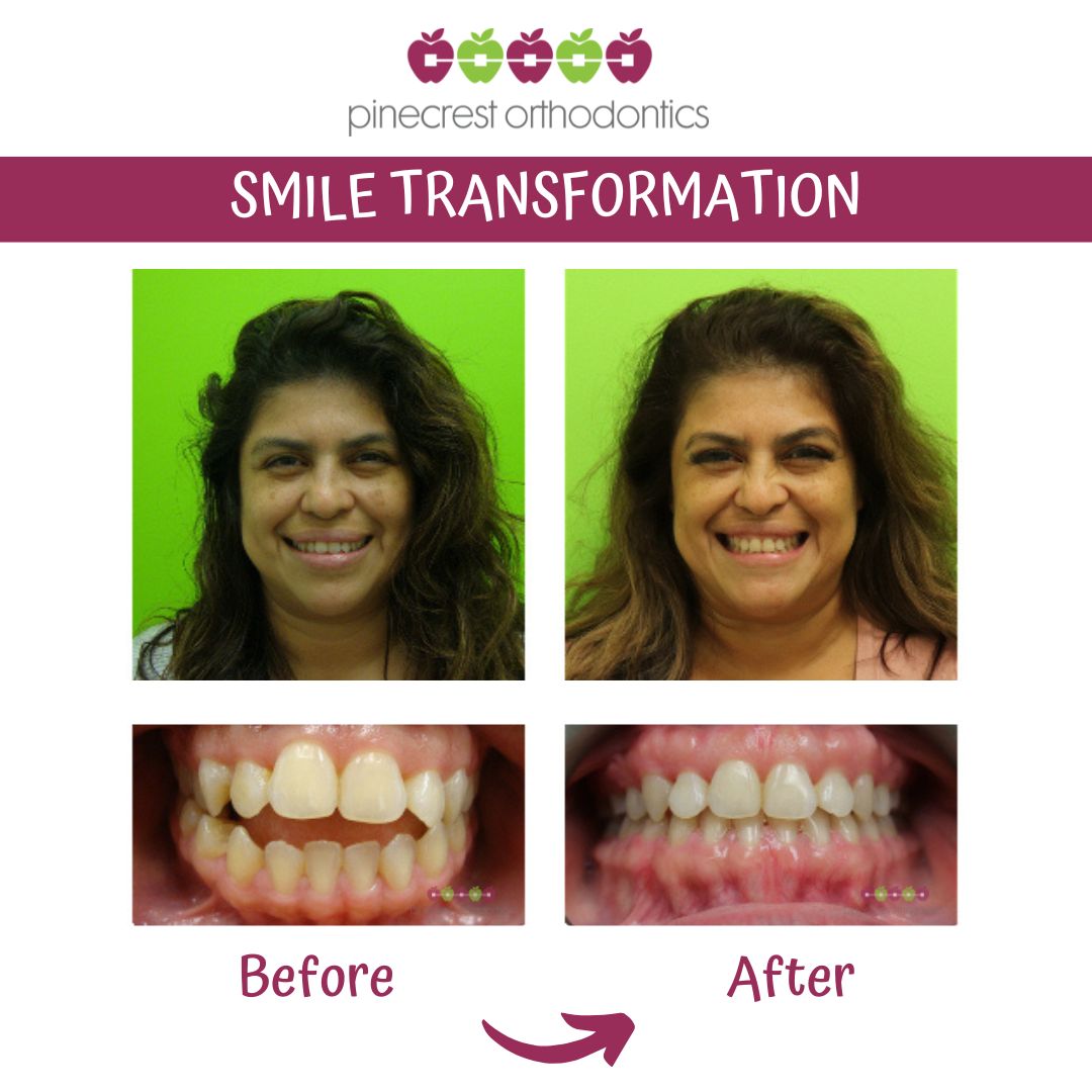 Pinecrest Orthodontics treatment area