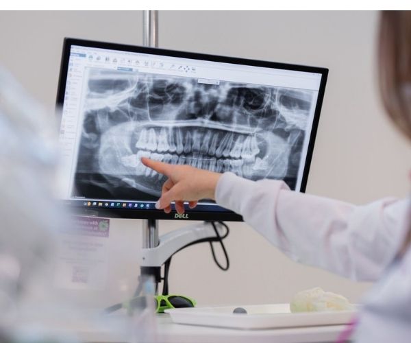 dr rothman expertise xray screen